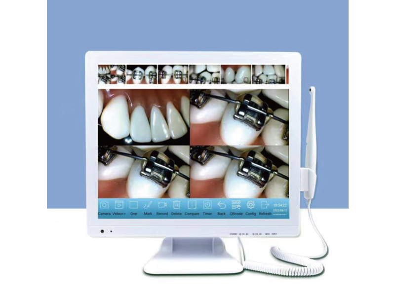 Intraoral-Camera-1